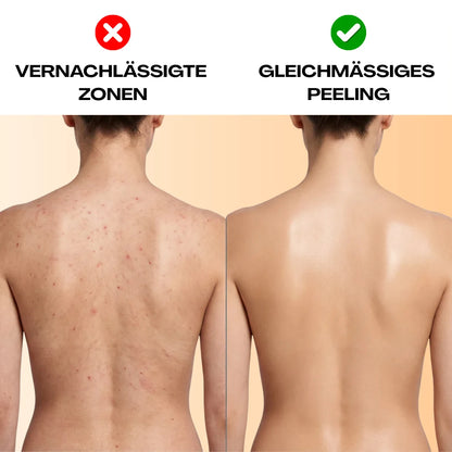 Vorher Nachher Vergleich am Rücken mit PeelingTuch Original für gleichmäßiges Peeling