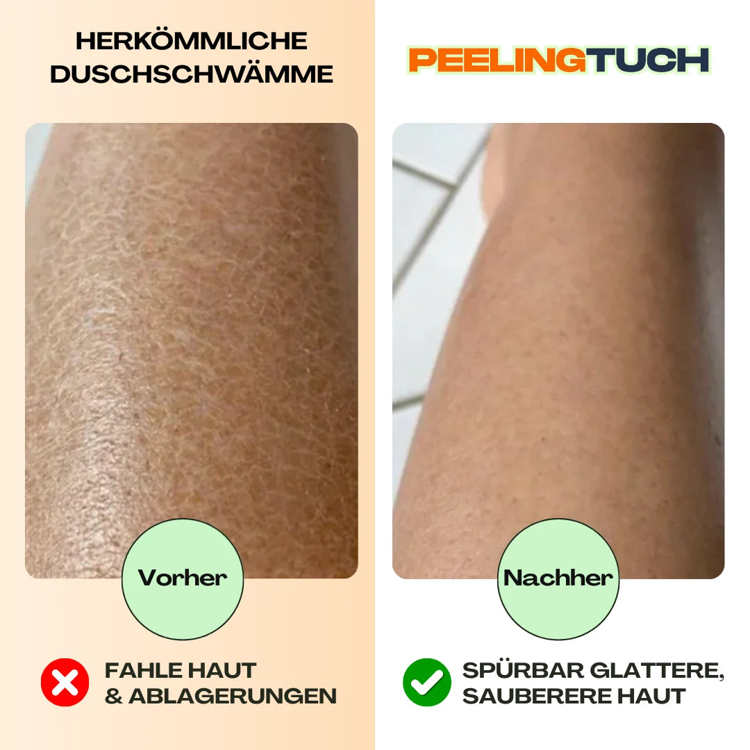 Vorher Nachher Vergleich der Haut mit PeelingTuch Original für sichtbar glattere und sauberere Haut